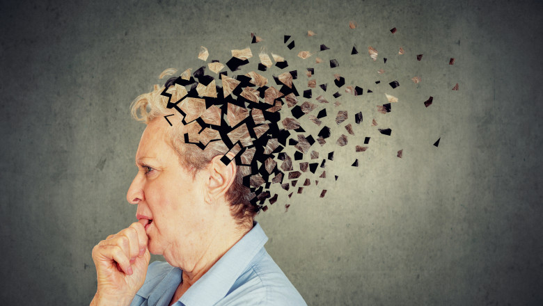 evolutia-alzheimer-la-femei,-accelerata-de-20-de-ori-comparativ-cu-barbatii-(studiu) evolutia-alzheimer-la-femei,-accelerata-de-20-de-ori-comparativ-cu-barbatii-(studiu)